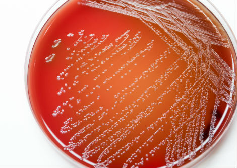 البكتيريا التي تزيد من نموّ سرطان القولون