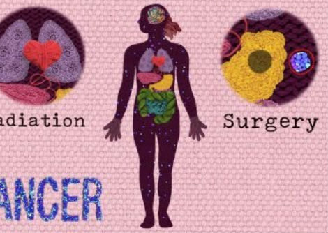 كيف تتصرف الخلايا السرطانية بشكل مختلف عن الأصحاء - جورج زيدان
