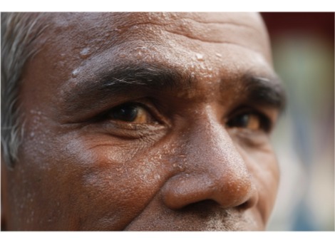 العالم يسخن. إلى أي مدى تستطيع أجسامنا تحمّل؟