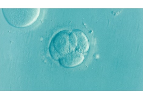 من الخلايا المفردة إلى الكائنات المعقدة: دراسة جديدة تُشير إلى أصول تعدد الخلايا في الحيوانات